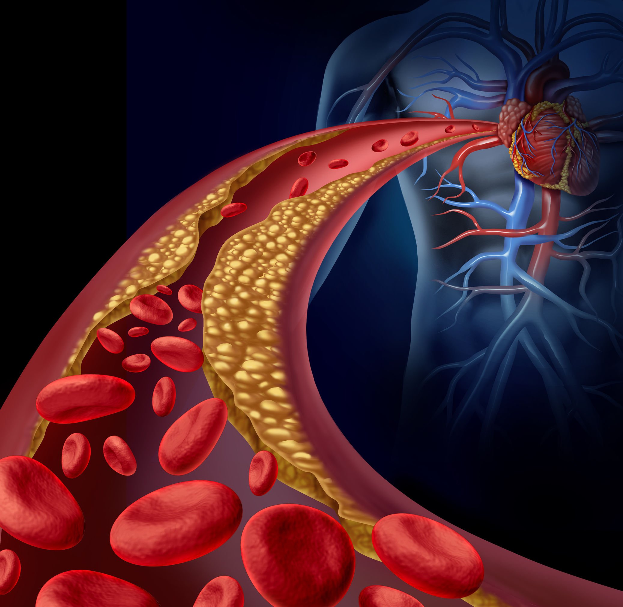 Novel Cholesterol Modifiers: Probiotics and Fruit Polyphenols