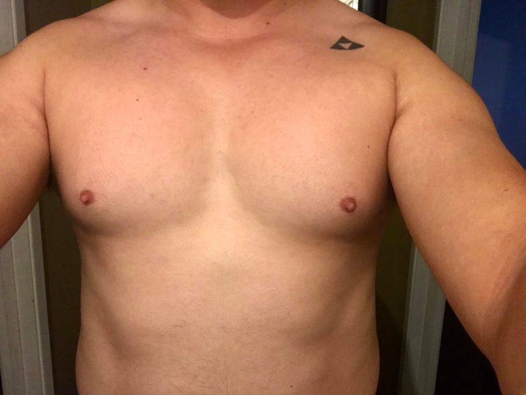 Hello, I have a question about my chest. My right pec muscle looks normal(square), while my left pec muscle rounds near the bottom corner. Theres also a gap in between. My exercises are; bench press, incline press, dumbell flys, dumbell pullover and chin ups. Why is my left pec looking like this?