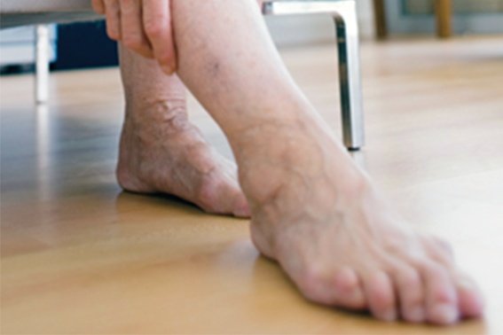 Homeopathy for blood circulation - DrHomeo Homeopathy