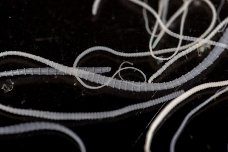 Using Parasitic Worms for Lowering Inflammation