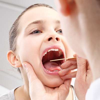 9 Effective Homeopathic remedies for follicular tonsillitis