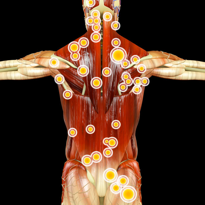 Optimizing Recovery: Using Acupuncture, Trigger-point Injection, & Red Light Therapy